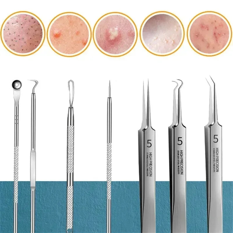 Blackhead Remover Kit